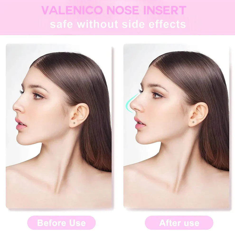 6Pc/Set Nose Shaping Insert