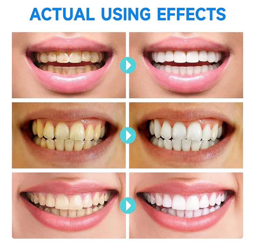 Niacinamide Whitening Toothpaste